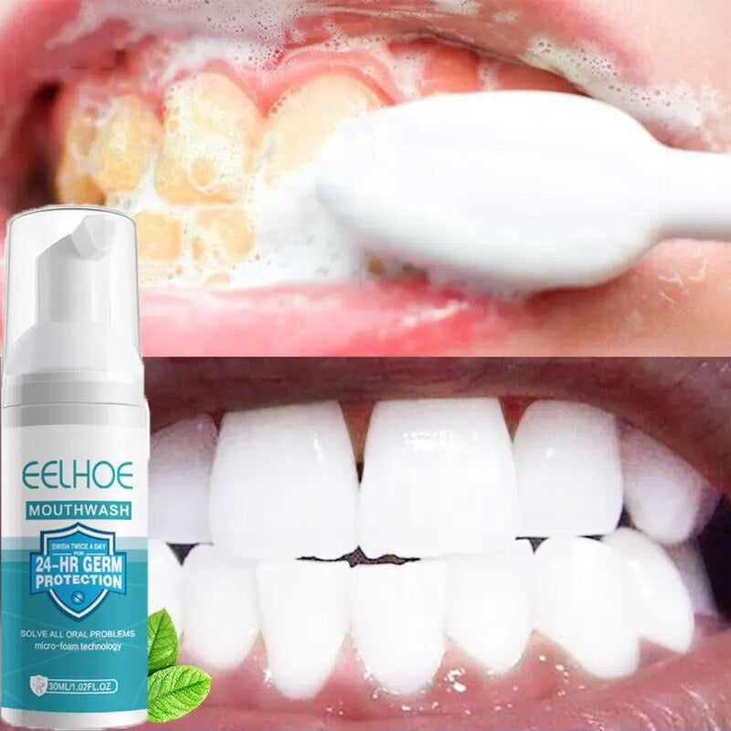 Teeth Whitening Mousse Toothpaste Dental Bleach Cleaning Tools Removes Stains Oral Hygiene Fresh Breath Teeth Whitener Products