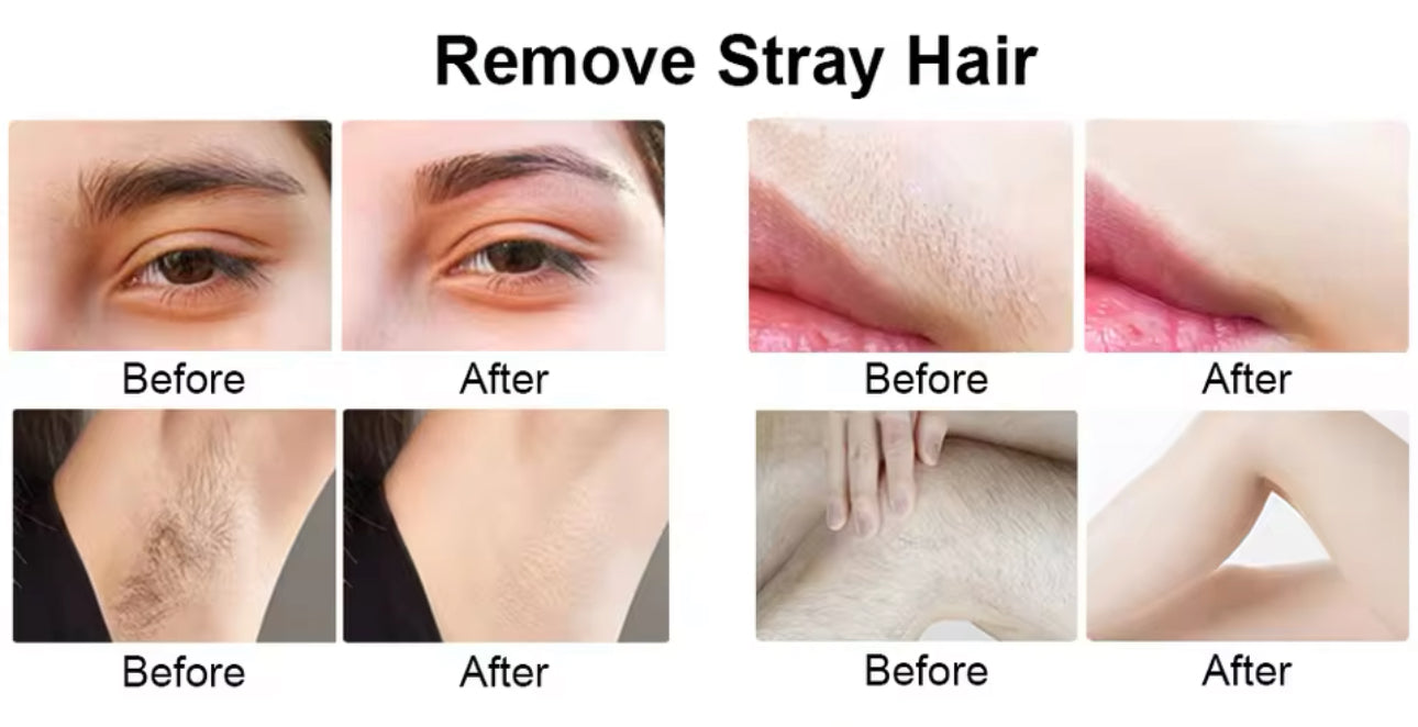 Professional Ladies 4 IN 1 Electric Epilator Hair Removal Kit V-725