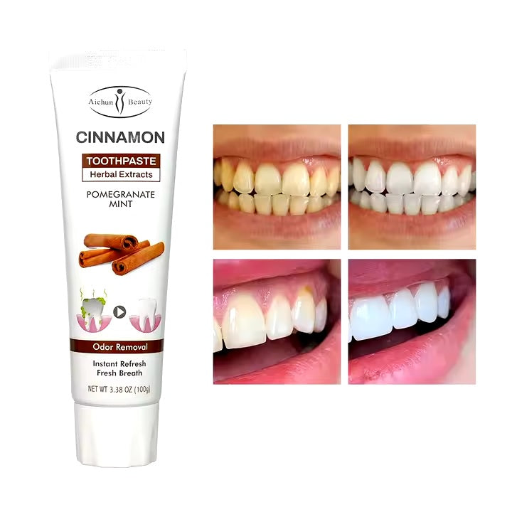 Aichun Beauty Cinnamon Toothpaste-100ml