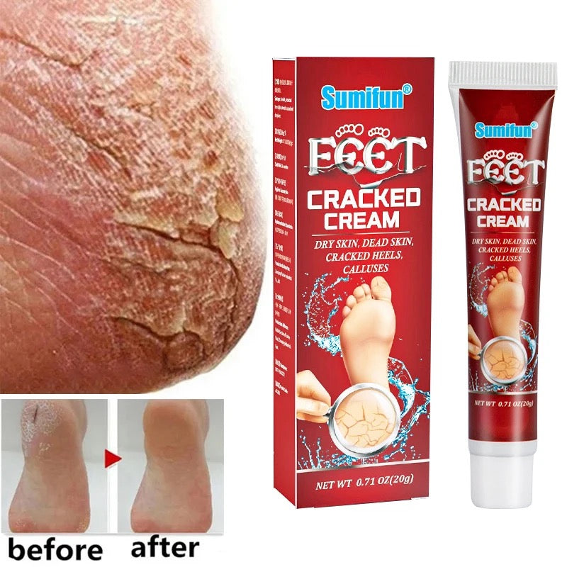 Anti Crack Foot Cream Oil Anti-Drying Crack Feet Cream Heel Cracked Repair Cream Removal Bad Skin Hand Feet Care Mask