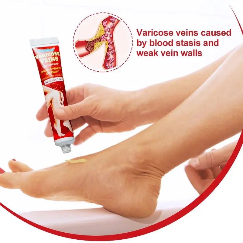 Sumifun Varicose Veins Ointment Vein Cream Veins For Treating Varicose Remover Effective & Original Cream Vasculitis Phlebitis Spider Pain Relief Plaster