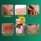 Psoriasis Cream
