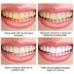 Teeth Whitening Mousse Toothpaste Dental Bleach Cleaning Tools Removes Stains Oral Hygiene Fresh Breath Teeth Whitener Products