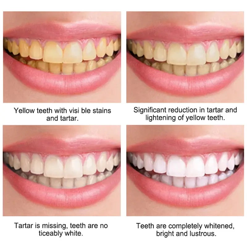 Teeth Whitening Mousse Toothpaste Dental Bleach Cleaning Tools Removes Stains Oral Hygiene Fresh Breath Teeth Whitener Products