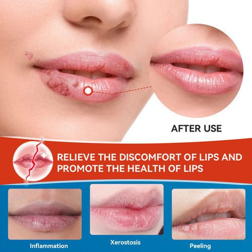 Hydrating Lip Therapy Cream Comfortable And Non-greasy Lip Cream Daytime Nighttime Lips Massage - 30G