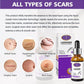Aichun Beauty Lavender Scar Repair Essence