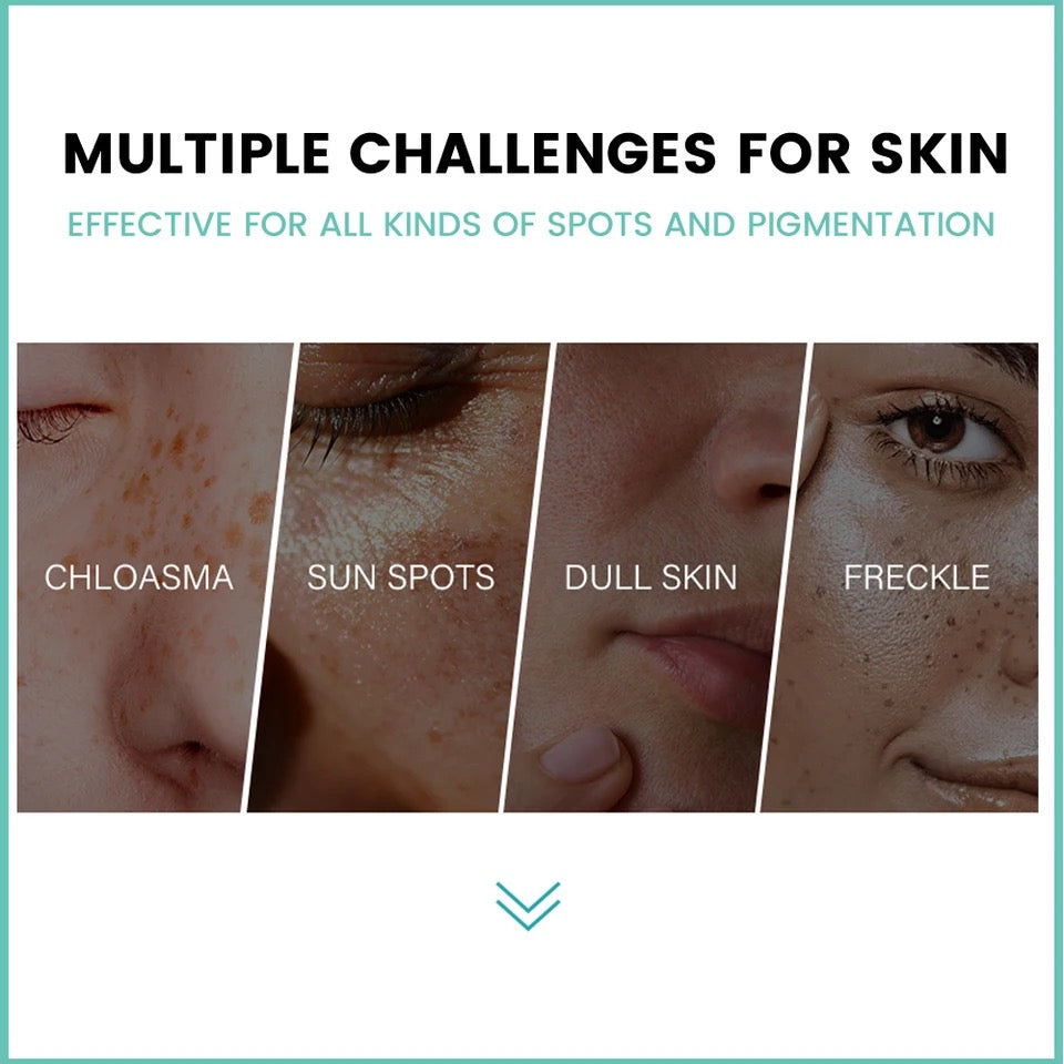 Dark Spot Corrector Cream Skin Whitening Spot Fade Anti-aging Cream For Women Girls Evens Skin Tone Skin Whitening Cream Face Repair Ointment Fade Dark Spot Freckles Skin Tone