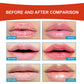 Hydrating Lip Therapy Cream Comfortable And Non-greasy Lip Cream Daytime Nighttime Lips Massage - 30G