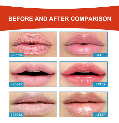 Hydrating Lip Therapy Cream Comfortable And Non-greasy Lip Cream Daytime Nighttime Lips Massage - 30G