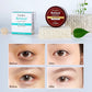 GuanJing Anti-Aging Eye Mask Retinol Nicotinamide Anti Wrinkle Concentrate Vitamin E A Moisturizes Lightens Stains