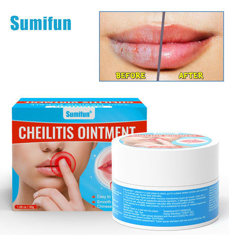 Hydrating Lip Therapy Cream Comfortable And Non-greasy Lip Cream Daytime Nighttime Lips Massage - 30G