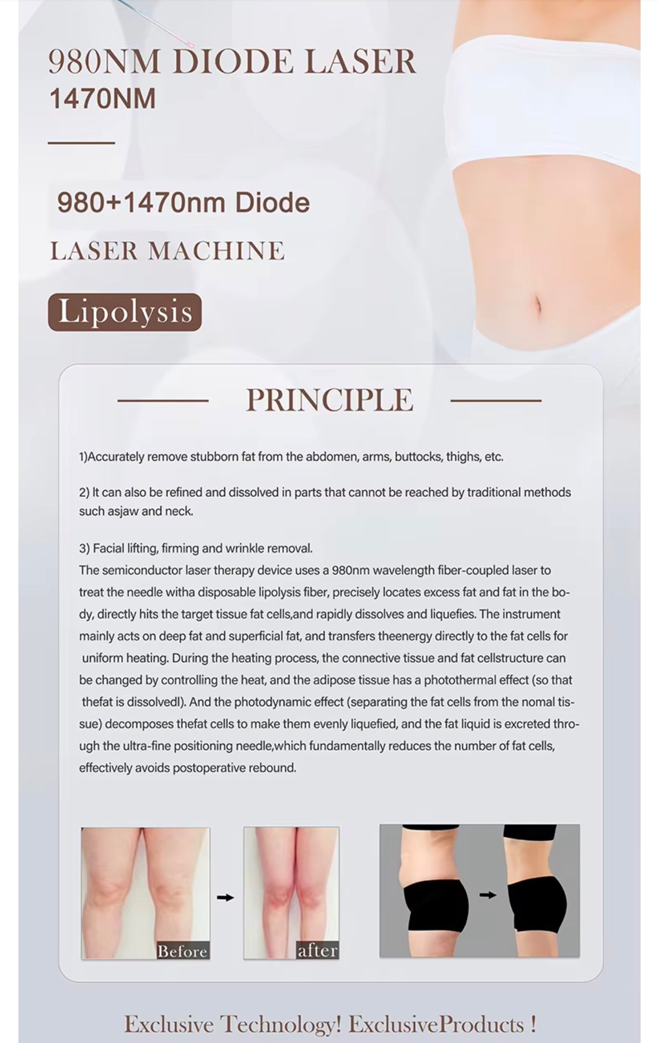 Professional Intelligent Diode Lazer Surgical Liposuction Weight Loss & Skin Tightening Machine - Only Available On Pre-Order