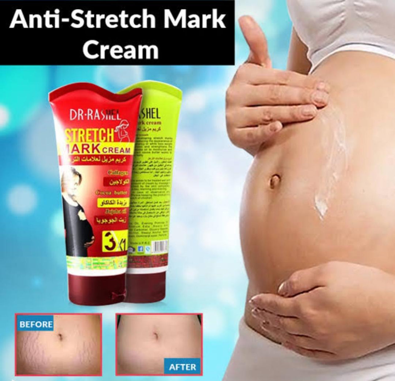 Dr Rashel Maternity Pregnancy Stretch Marks Removal Cream