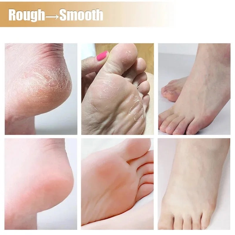 Anti Crack Foot Cream Oil Anti-Drying Crack Feet Cream Heel Cracked Repair Cream Removal Bad Skin Hand Feet Care Mask