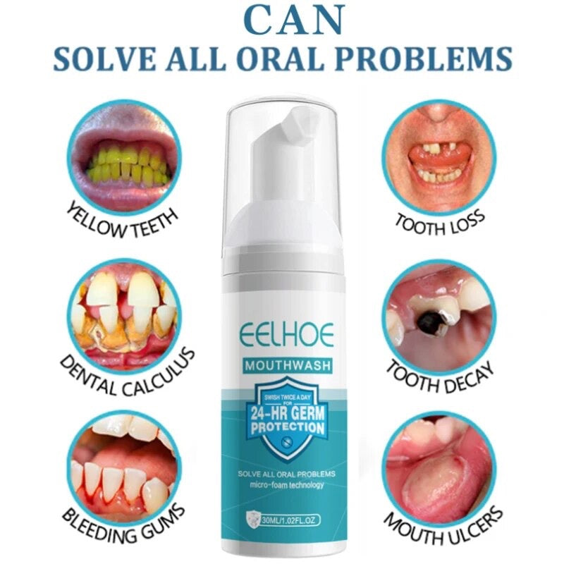 Teeth Whitening Mousse Toothpaste Dental Bleach Cleaning Tools Removes Stains Oral Hygiene Fresh Breath Teeth Whitener Products