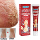 Anti Crack Foot Cream Oil Anti-Drying Crack Feet Cream Heel Cracked Repair Cream Removal Bad Skin Hand Feet Care Mask