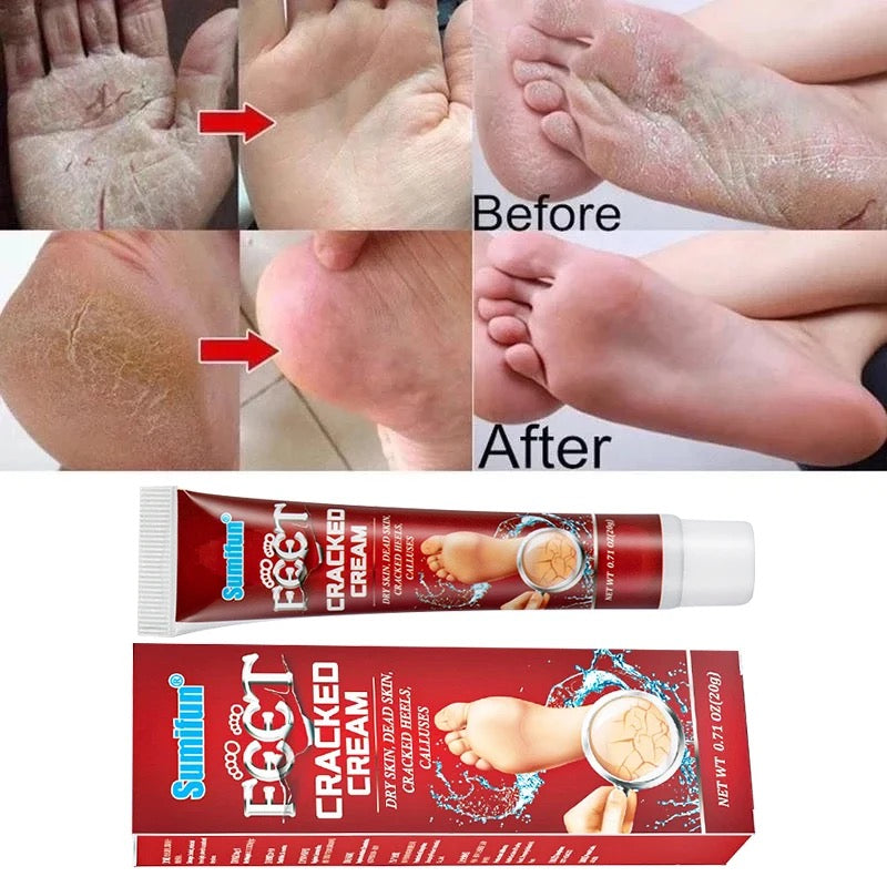 Anti Crack Foot Cream Oil Anti-Drying Crack Feet Cream Heel Cracked Repair Cream Removal Bad Skin Hand Feet Care Mask