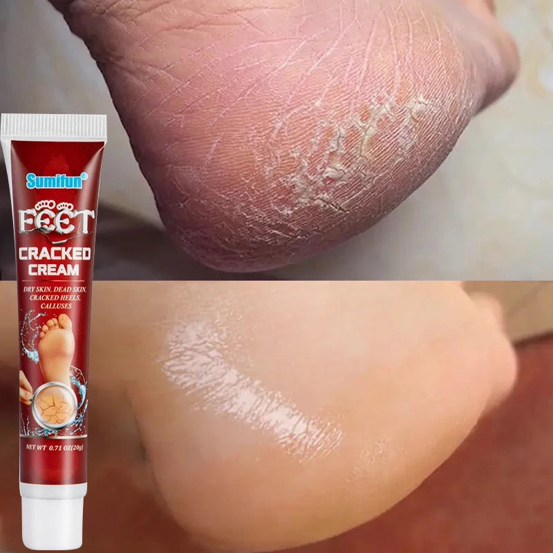 Anti Crack Foot Cream Oil Anti-Drying Crack Feet Cream Heel Cracked Repair Cream Removal Bad Skin Hand Feet Care Mask