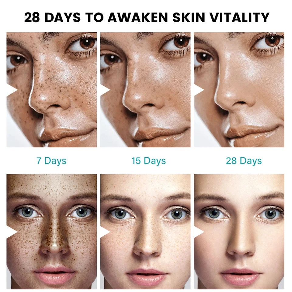 Dark Spot Corrector Cream Skin Whitening Spot Fade Anti-aging Cream For Women Girls Evens Skin Tone Skin Whitening Cream Face Repair Ointment Fade Dark Spot Freckles Skin Tone