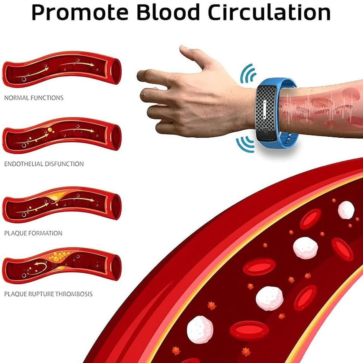 Ultrasonic Anti Mosquito Insect Pest Bug Repellent Repeller Bracelet Watch Wrist