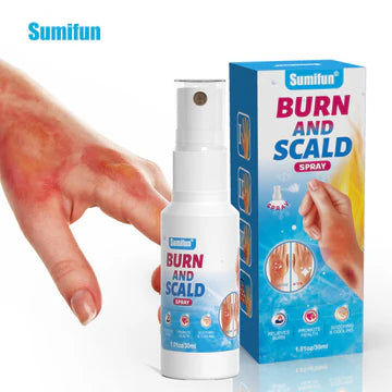 Burn & Scald Relief Spray with Lidocaine 2% 200ML – Cooling Pain Relief for Minor Burns, Sunburn & Skin Irration