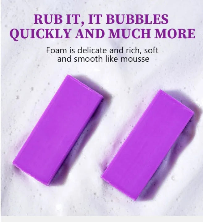 Beauty Anti Acne Fade Acne Marks Handmade Body and Face Soap-120g 4:1/ 4pc