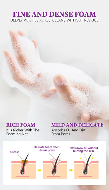 Beauty Anti Acne Fade Acne Marks Handmade Body and Face Soap-120g 4:1/ 4pc