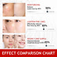 Kojic Acid Essence Toner Repair Brighten Essence Anti Wrinkle Moisturizing Refining Pores Skin Care Serum 100ml