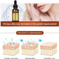 Scar and Acne Mark Removal Repair Essence