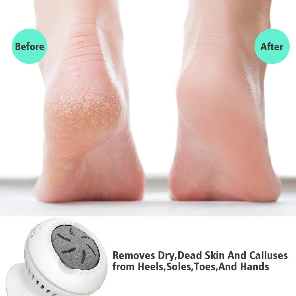 Storm Foot Callus Vacuum