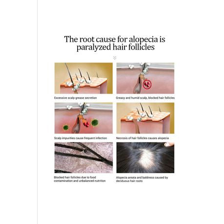 Anti-Hair Loss Shampoo and Essential Oil Treatment Hair Care