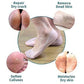 Silicone Smiling Foot