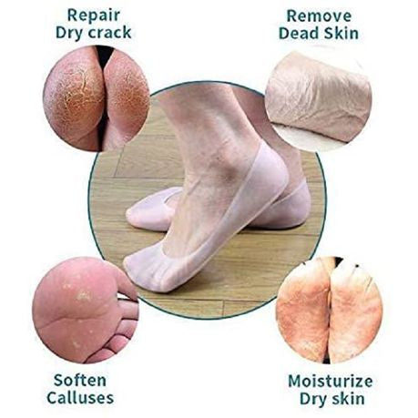 Silicone Smiling Foot