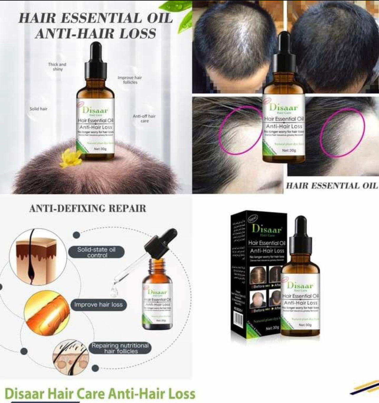 Anti-Hair Loss Shampoo and Essential Oil Treatment Hair Care