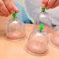 Chinese Body Cupping Massage Suction Therapy