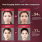 Electric V-Face Shaping Massager Face-Lift Slim Double Chin Removal Instrument