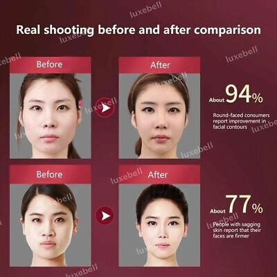 Electric V-Face Shaping Massager Face-Lift Slim Double Chin Removal Instrument