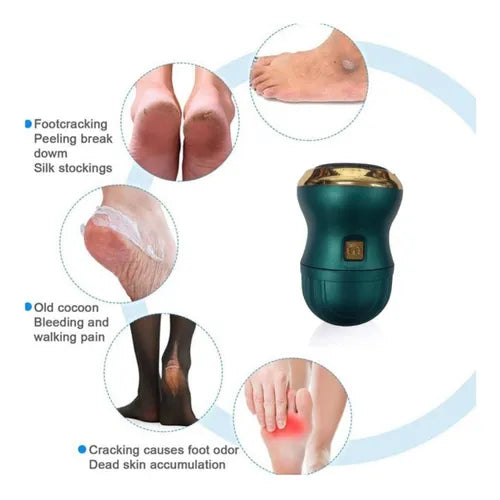 Callus Remover with built in Vacuum