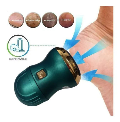 Callus Remover with built in Vacuum