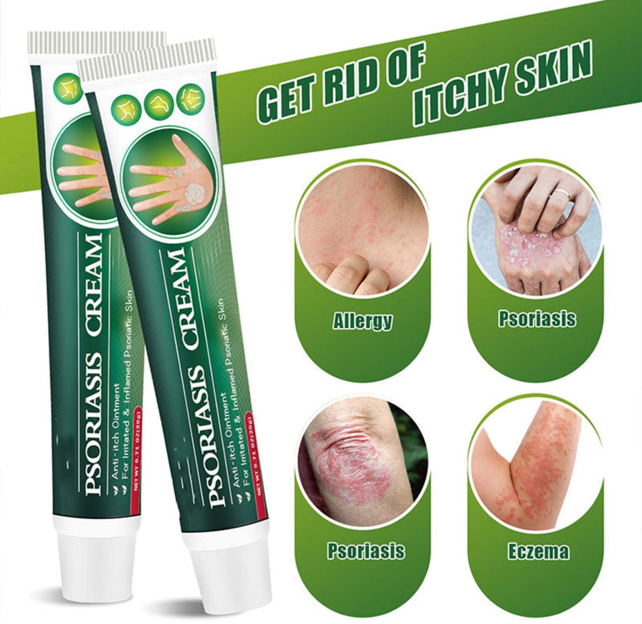 Skinmedix Psoriasis Cream, Zlimplify Psoriasis Cream, Psoriasis Control Face and Body Cream, Natural Chinese Herbal Eczema