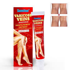 Sumifun Varicose Veins Ointment Vein Cream Veins For Treating Varicose Remover Effective & Original Cream Vasculitis Phlebitis Spider Pain Relief Plaster