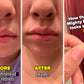 Acne Pimple Mighty Patch
